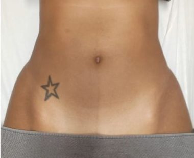 Body sculpting _massage_antes