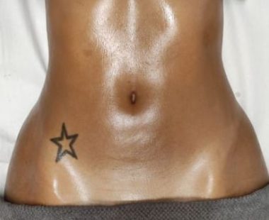 Body sculpting_massage_despues